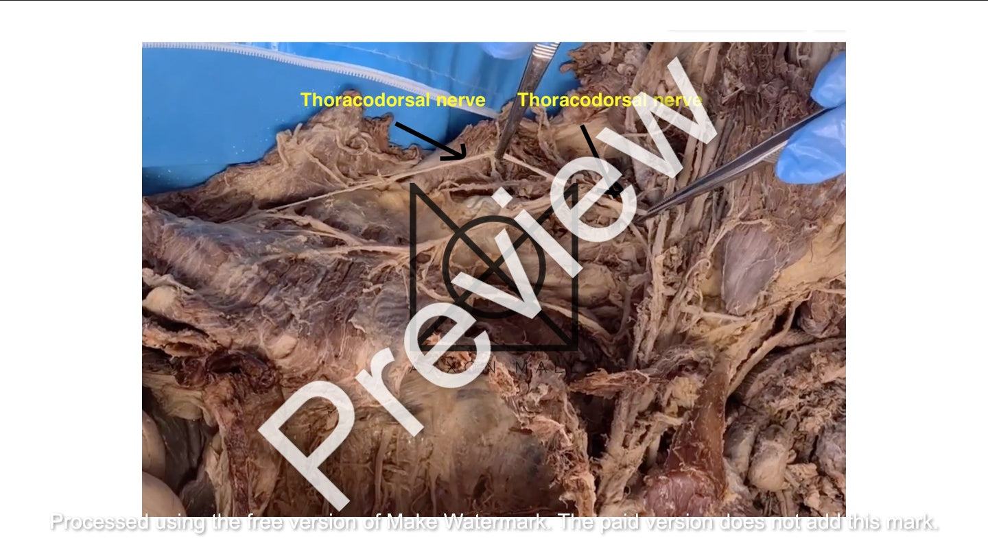 Thorax (Pictorial Presentation)