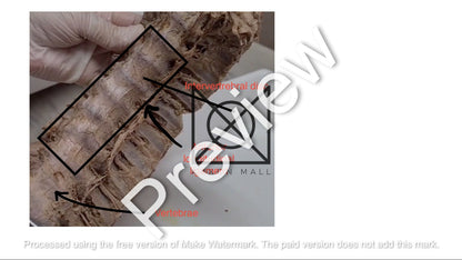 Thorax (Pictorial Presentation)
