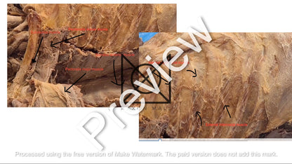 Thorax (Pictorial Presentation)