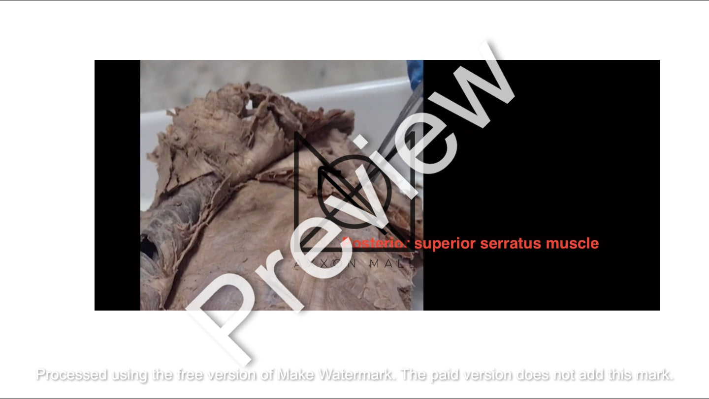 Thorax (Pictorial Presentation)