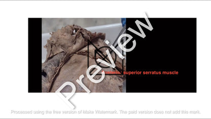 Thorax (Pictorial Presentation)