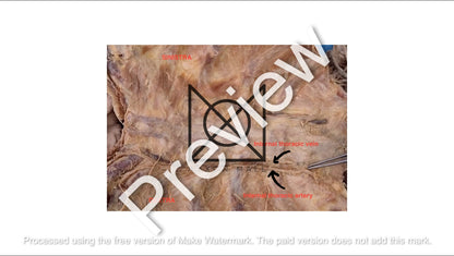 Thorax (Pictorial Presentation)