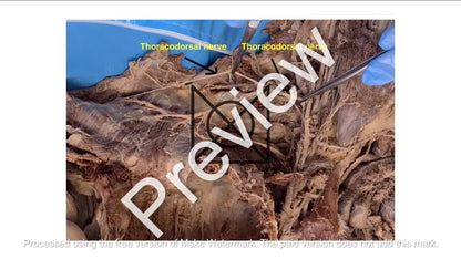 Thorax (Pictorial Presentation)