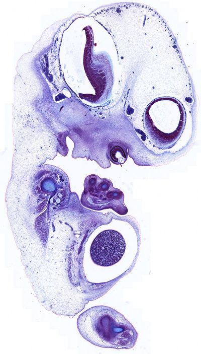Embryology Summary by MDDr. Uta Hüning