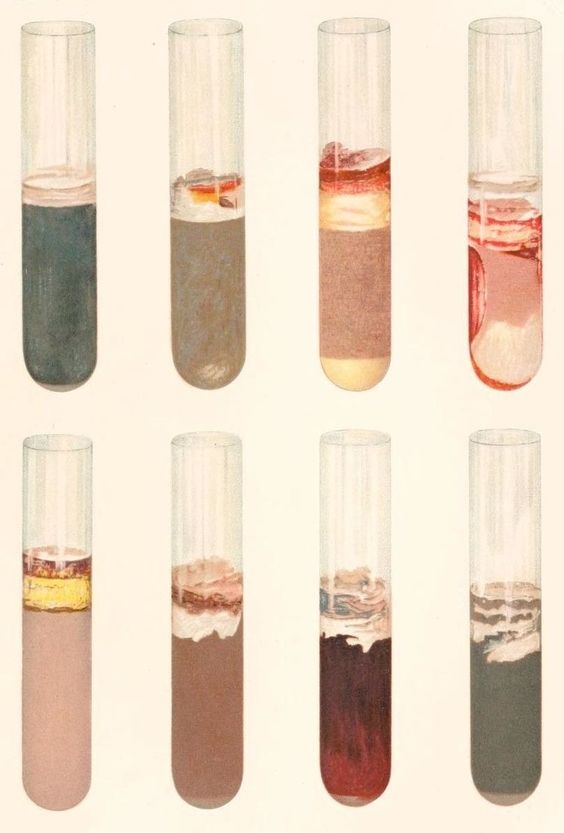 Immunology Lecture Summary by Rosa Weiß